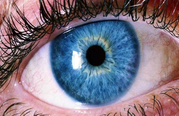 Dry Eye Relief